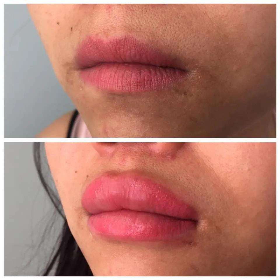 Avant après restructuration sourcils effet défini Antibes